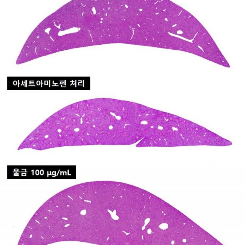 한의학술정보