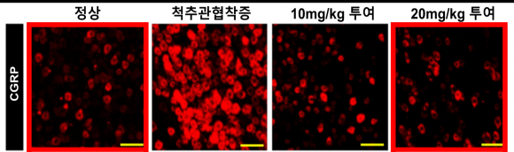 [사진설명] 동물실험에서도 후근신경절(DRG) 조직에서 자하거 약침 투여량에 따라 통증 관련 단백질(CGRP)이 농도의존적으로 회복됐다[병원 제공]